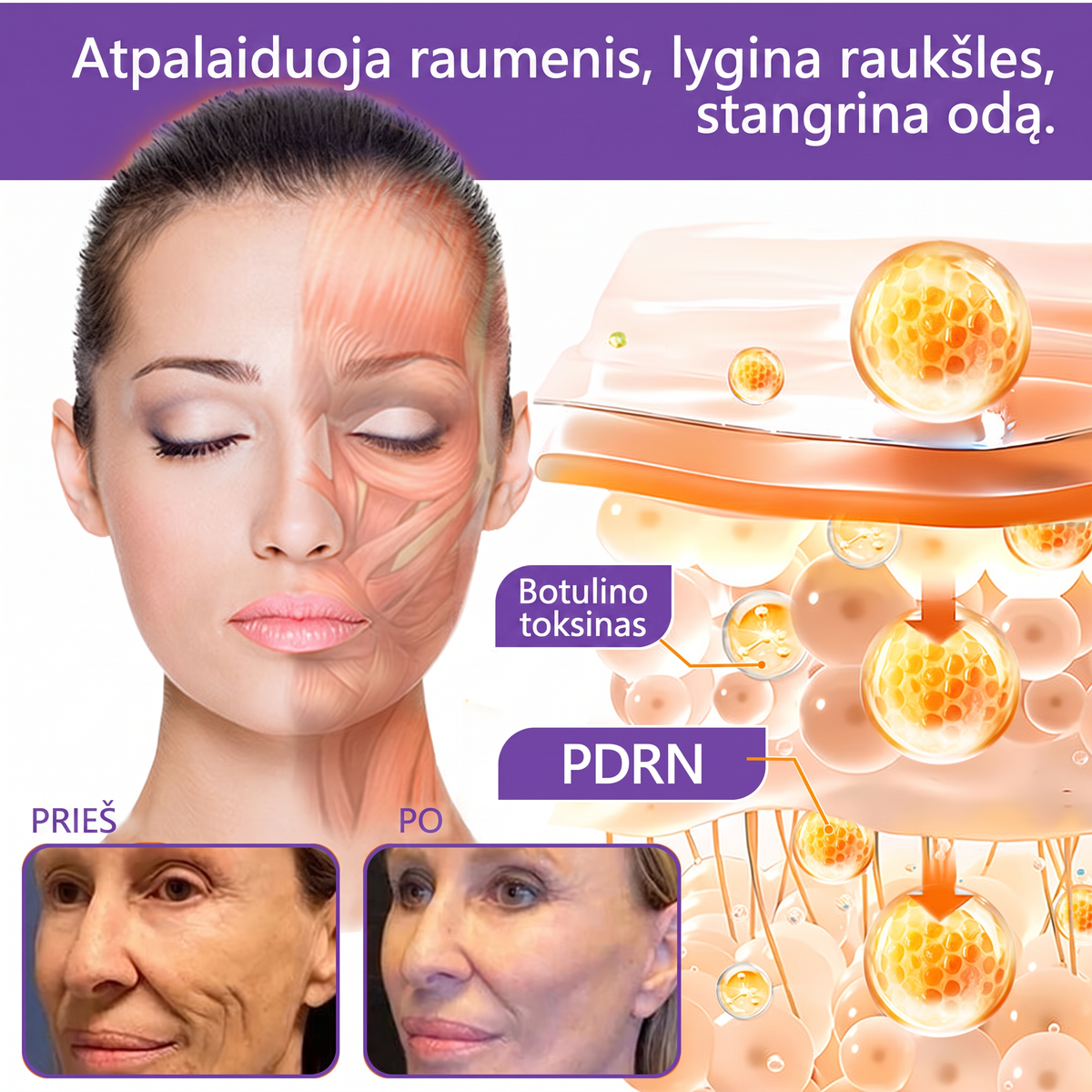 Ekspertų rekomenduojama🥦 |🌥️Vitalisys® PDRN“daugiapeptidis masažuojamasis kūno kremas – Anti-senėjimo, drėkinamasis,stangrinamasis,odą regeneruojantis,sulyginantis,spuogų ir dėmių šalinimo,karpų ir apgamų šalinimo, psoriazės palengvinimo priemonė.👒