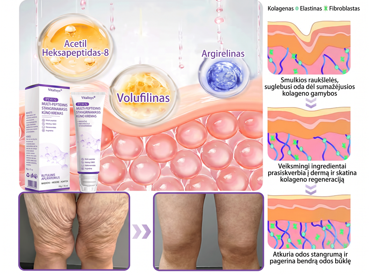 Ekspertų rekomenduojama🥦 |🌥️Vitalisys® PDRN“daugiapeptidis masažuojamasis kūno kremas – Anti-senėjimo, drėkinamasis,stangrinamasis,odą regeneruojantis,sulyginantis,spuogų ir dėmių šalinimo,karpų ir apgamų šalinimo, psoriazės palengvinimo priemonė.👒