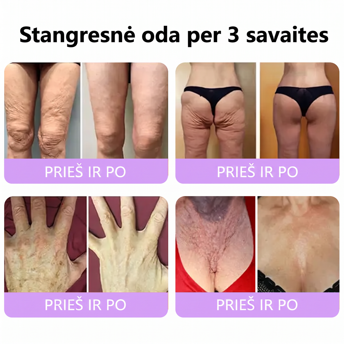 Ekspertų rekomenduojama🥦 |🌥️Vitalisys® PDRN“daugiapeptidis masažuojamasis kūno kremas – Anti-senėjimo, drėkinamasis,stangrinamasis,odą regeneruojantis,sulyginantis,spuogų ir dėmių šalinimo,karpų ir apgamų šalinimo, psoriazės palengvinimo priemonė.👒