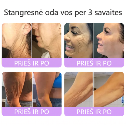 Ekspertų rekomenduojama🥦 |🌥️Vitalisys® PDRN“daugiapeptidis masažuojamasis kūno kremas – Anti-senėjimo, drėkinamasis,stangrinamasis,odą regeneruojantis,sulyginantis,spuogų ir dėmių šalinimo,karpų ir apgamų šalinimo, psoriazės palengvinimo priemonė.👒
