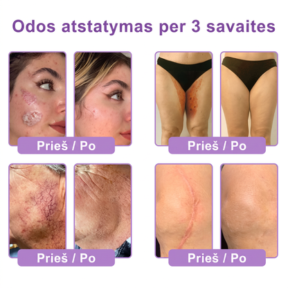 Ekspertų rekomenduojama🥦 |🌥️Vitalisys® PDRN“daugiapeptidis masažuojamasis kūno kremas – Anti-senėjimo, drėkinamasis,stangrinamasis,odą regeneruojantis,sulyginantis,spuogų ir dėmių šalinimo,karpų ir apgamų šalinimo, psoriazės palengvinimo priemonė.👒