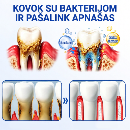 Rekomenduojamas odontologų 👨‍⚕️🦷🛡️ Vitalisys® GumRevive – regeneruojantis dantenų gelis 🐟❤️