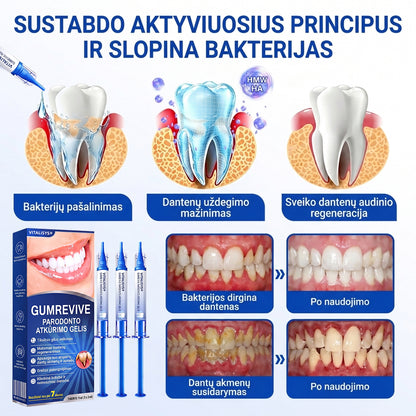 Rekomenduojamas odontologų 👨‍⚕️🦷🛡️ Vitalisys® GumRevive – regeneruojantis dantenų gelis 🐟❤️